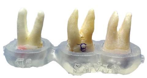 3D Endodontics — photo 3