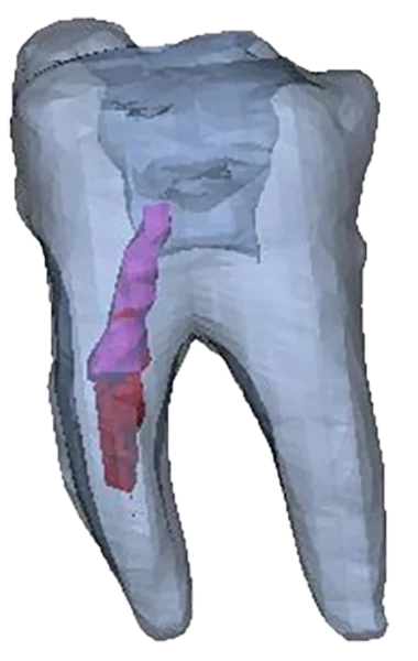 3D Endodontics — photo 4