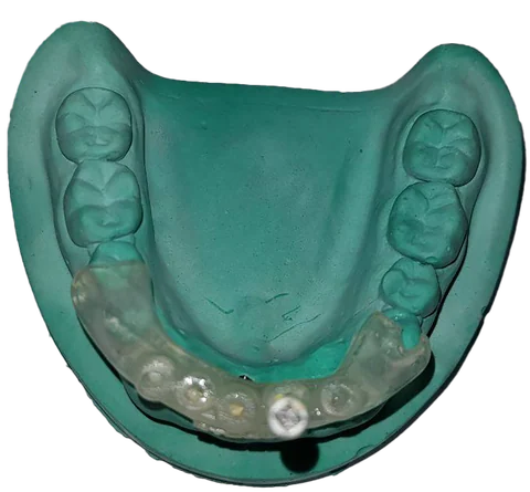 3D Endodontics — photo 6