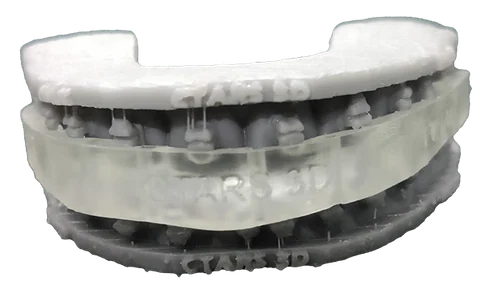 Bitemarks — Orthognathic 3D Splints — photo 2