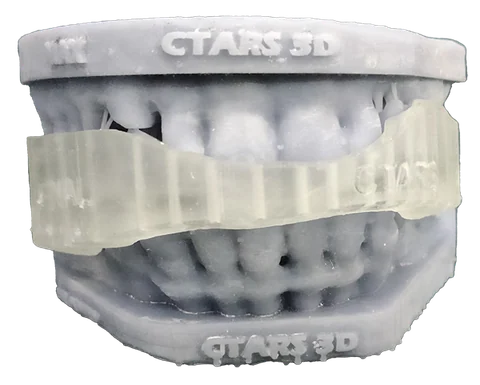 Bitemarks — Orthognathic 3D Splints — photo 3