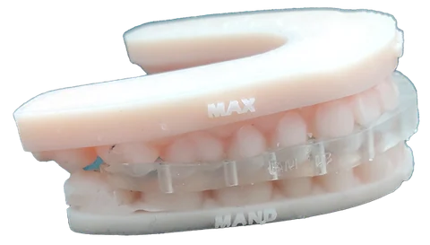 Bitemarks — Orthognathic 3D Splints — photo 4