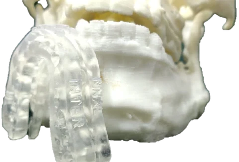 Bitemarks — Orthognathic 3D Splints — photo 5