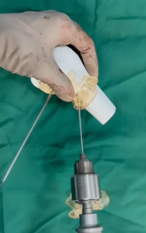 CTARS orthopaedic model — photo 2