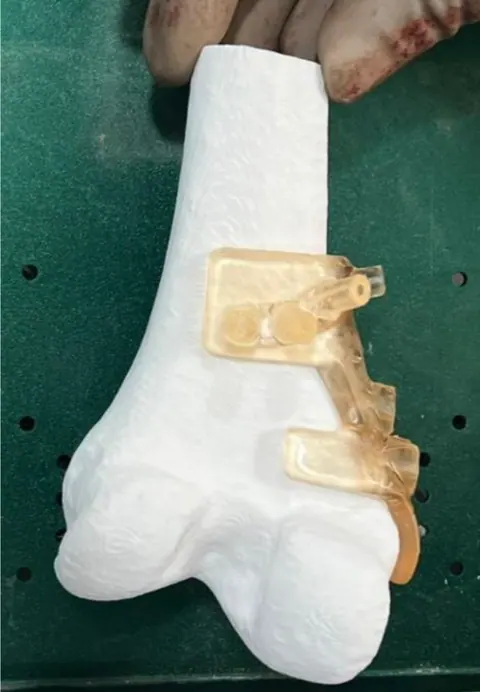 CTARS orthopaedic model — photo 6