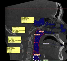 SRP — Surgical Rehearsal Platform — photo 3